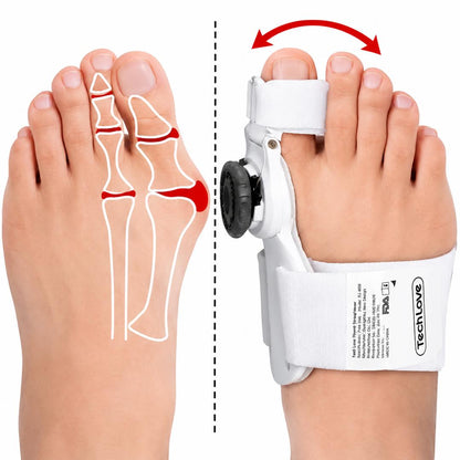 Correcteur d’Oignon Ajustable