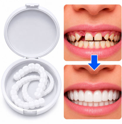 Facettes adaptables et amovibles : Haut + Bas 🦷