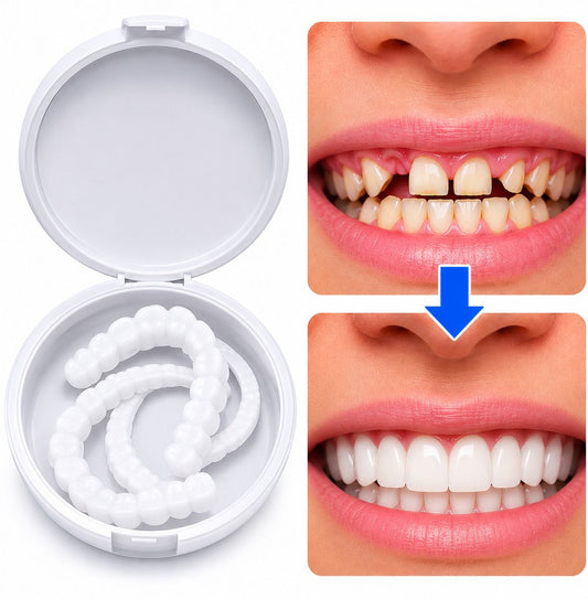 Facettes adaptables et amovibles : Haut + Bas 🦷